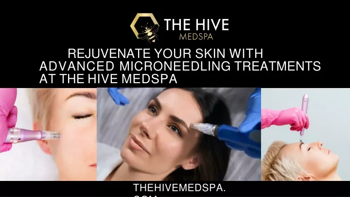 rejuvenate your skin with advanced microneedling treatments at the hive medspa