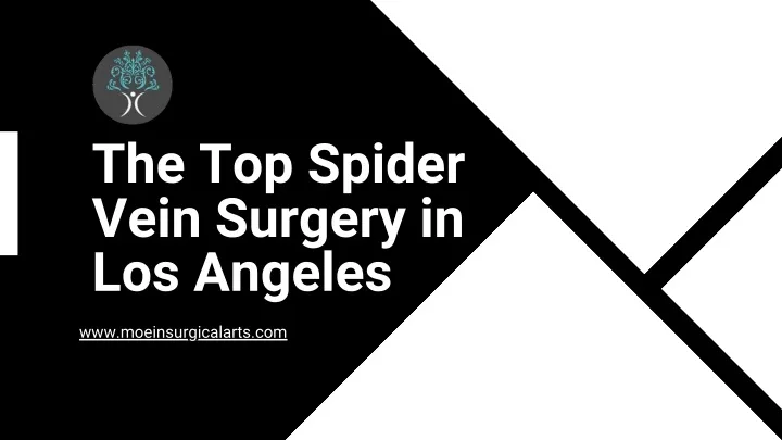 the top spider vein surgery in los angeles