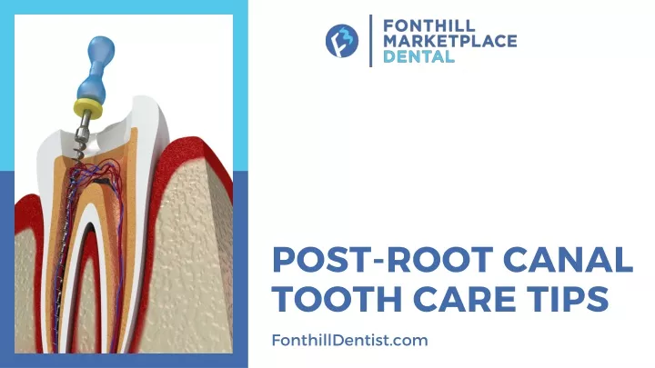 PPT - Post Root Canal Tooth Care Tips PowerPoint Presentation, free ...