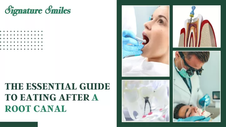 the essential guide to eating after a root canal