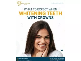 Dental Crowns in Chandigarh