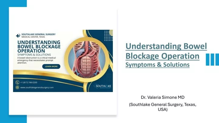 understanding bowel blockage operation symptoms