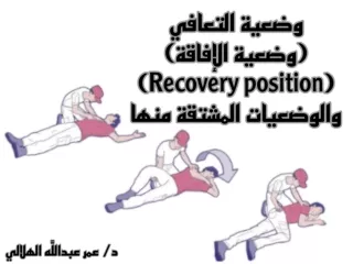 الإفاقة والوضعيات المشتقة منها