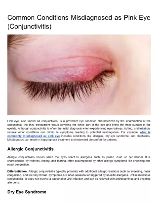 Common Conditions Misdiagnosed as Pink Eye (Conjunctivitis)