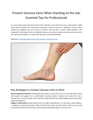Prevent Varicose Veins When Standing on the Job