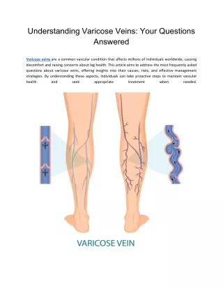 Understanding Varicose Veins: Your Questions Answered