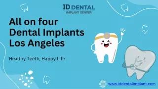 All On Four Dental Implants Los Angeles