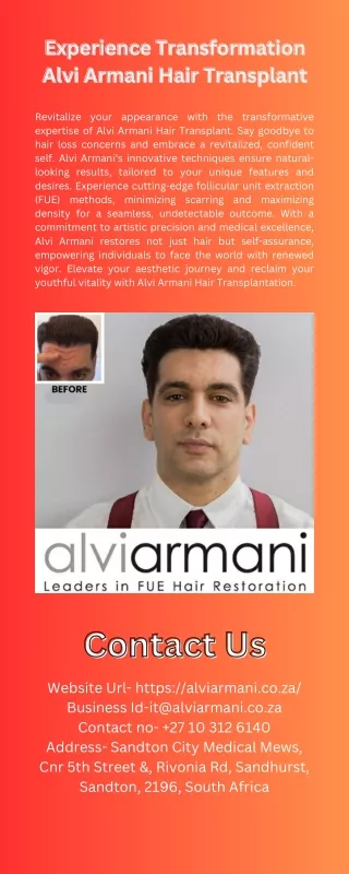 Experience Transformation Alvi Armani Hair Transplant