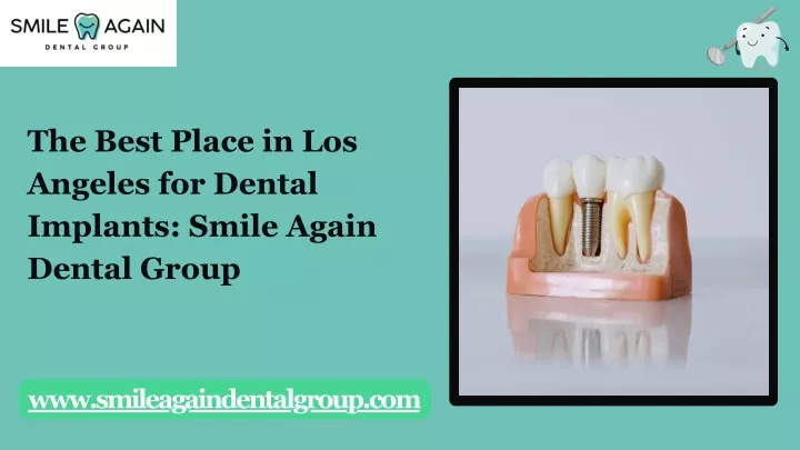 the best place in los angeles for dental implants