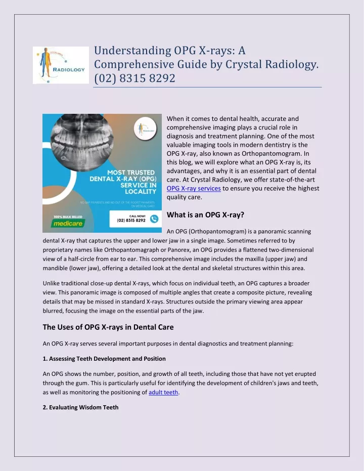 understanding opg x rays a comprehensive guide