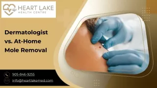 Dermatologist vs. At-Home Mole Removal Treatment