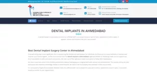 DENTAL IMPLANTS AHMEDABAD