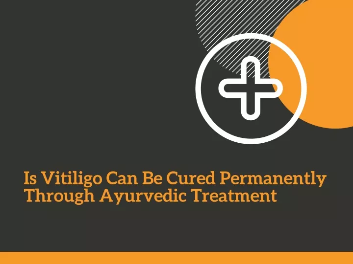 is vitiligo can be cured permanently through