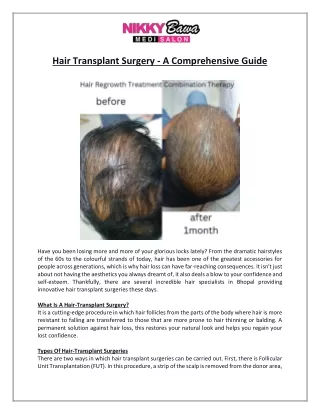 Hair Transplant Surgery - A Comprehensive Guide