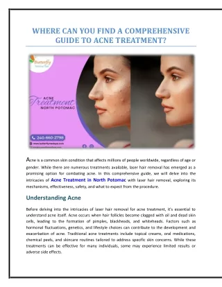 Where Can You Find a Comprehensive Guide to Acne Treatment?