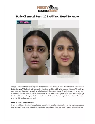 Nikky Bawa Medisalon - Body Chemical Peels - All You Need To Know