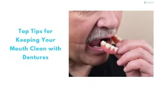 Top Tips for Keeping Your Mouth Clean with Dentures