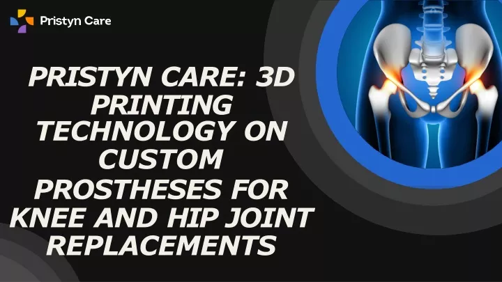 pristyn care 3d printing technology on custom