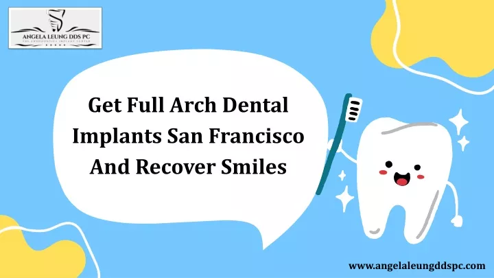 get full arch dental implants san francisco