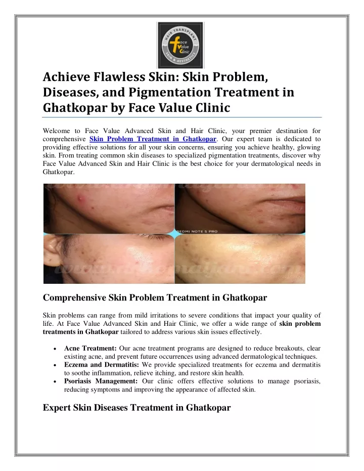 achieve flawless skin skin problem diseases