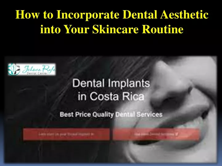 how to incorporate dental aesthetic into your