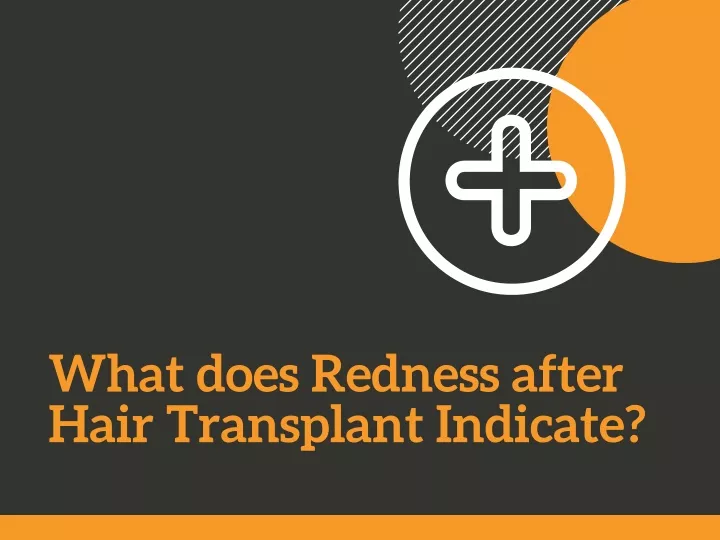 what does redness after hair transplant indicate