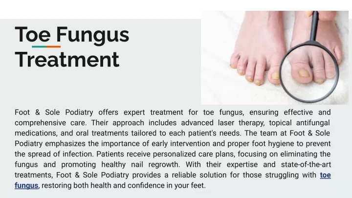 toe fungus treatment