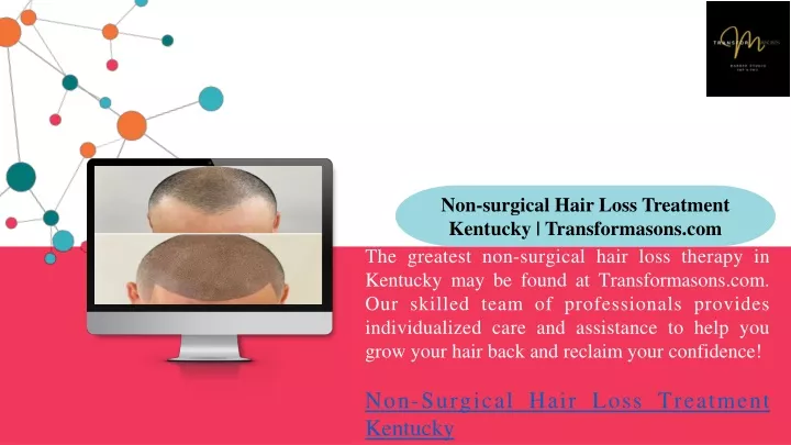 non surgical hair loss treatment kentucky