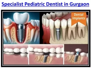 Dental Aesthetics & Root Canal Treatment in Gurgaon