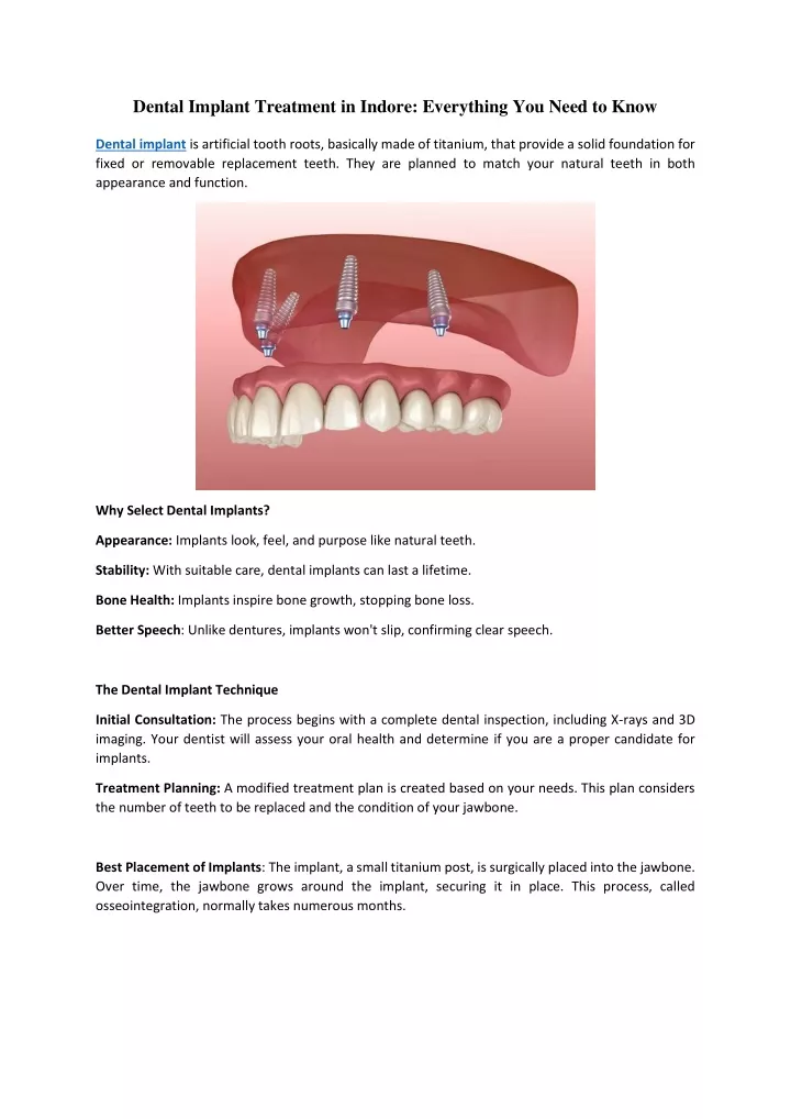 dental implant treatment in indore everything