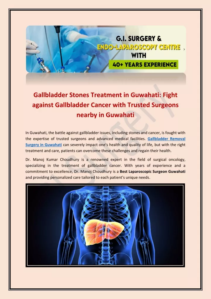 gallbladder stones treatment in guwahati fight