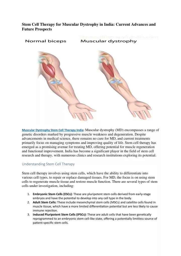 stem cell therapy for muscular dystrophy in india