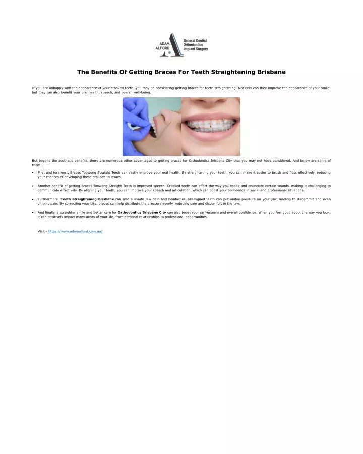 the benefits of getting braces for teeth