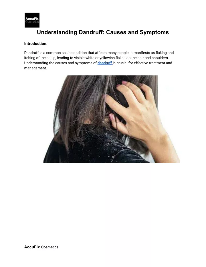 understanding dandruff causes and symptoms