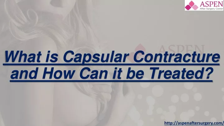 what is capsular contracture and how can it be treated