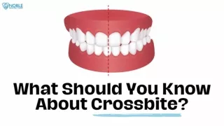 What Should You Know About Crossbite
