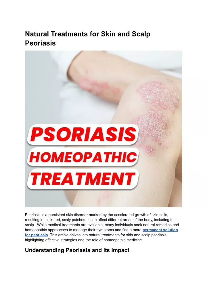 natural treatments for skin and scalp psoriasis