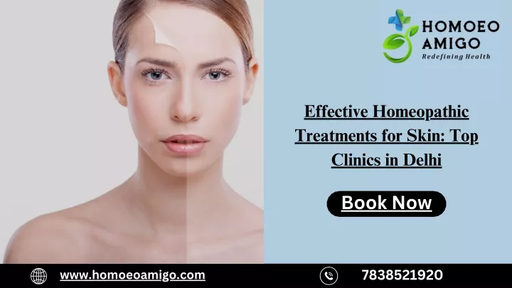 effective homeopathic treatments for skin