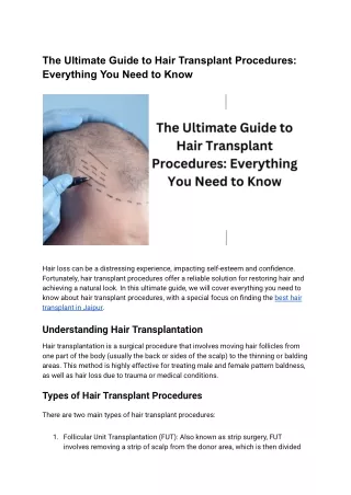 The Ultimate Guide to Hair Transplant Procedures_ Everything You Need to Know