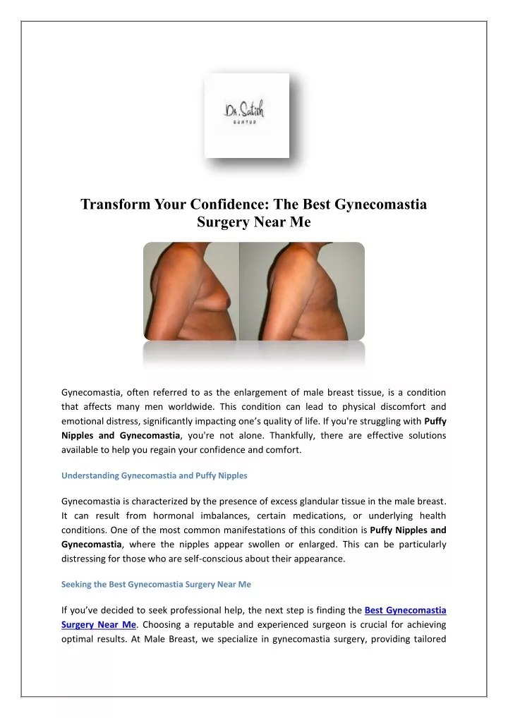 transform your confidence the best gynecomastia