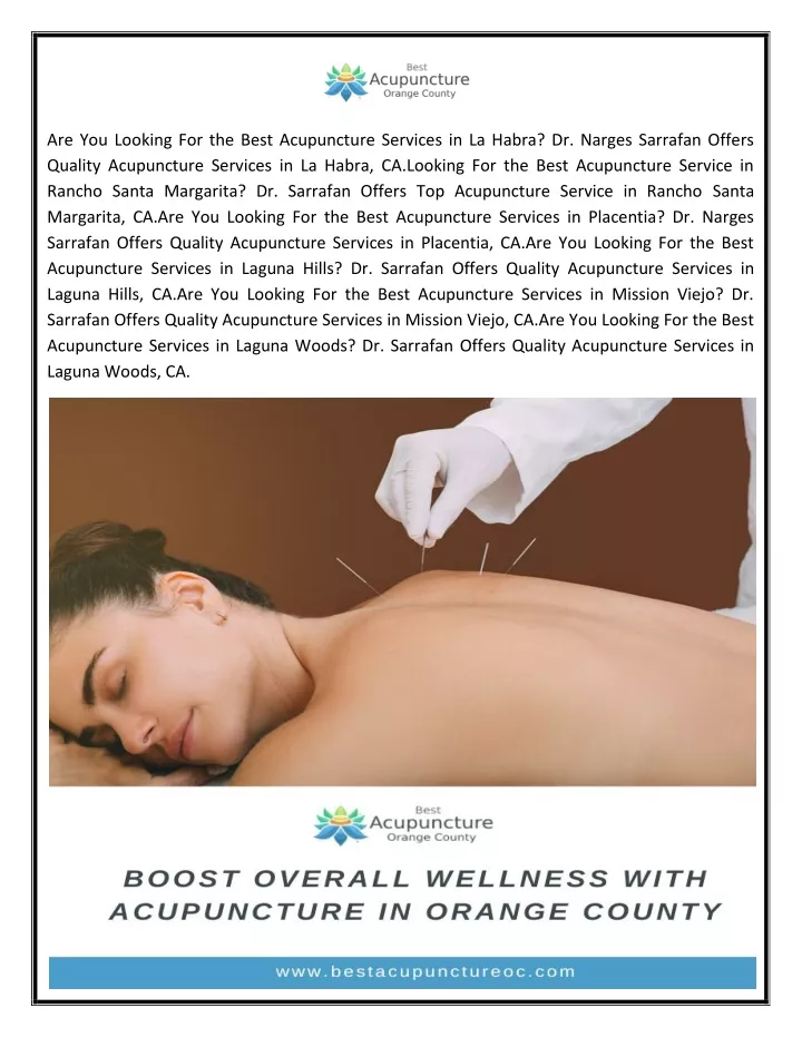 are you looking for the best acupuncture services