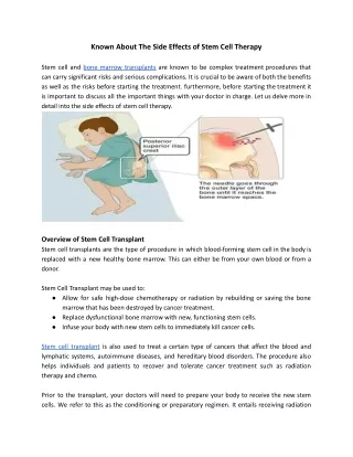 Off page_ Known About The Side Effects of Stem Cell Therapy