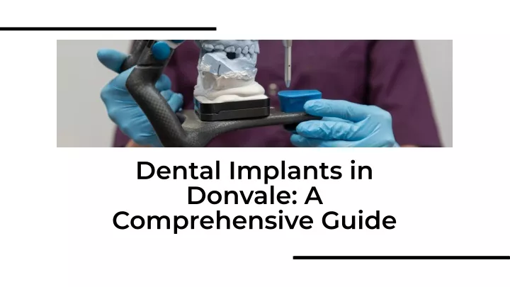 dental implants in donvale a comprehensive guide