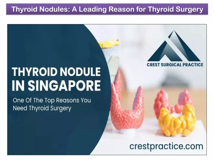 thyroid nodules a leading reason for thyroid