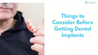 Things to Consider Before Getting Dental Implants