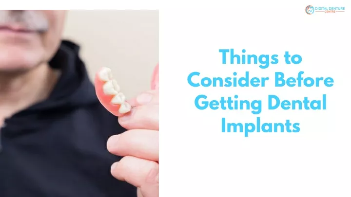 things to consider before getting dental implants