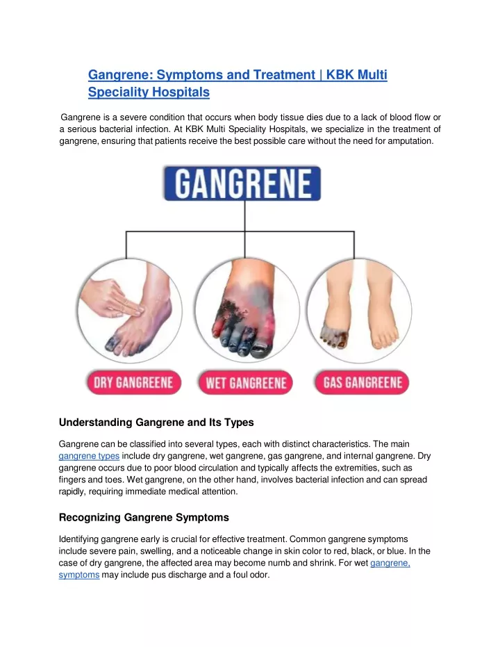 gangrene symptoms and treatment kbk multi