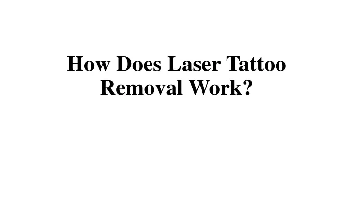 how does laser tattoo removal work