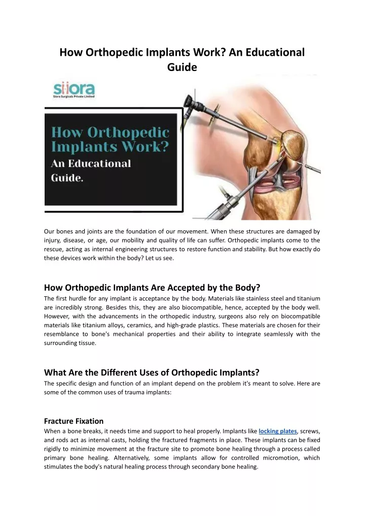 how orthopedic implants work an educational guide