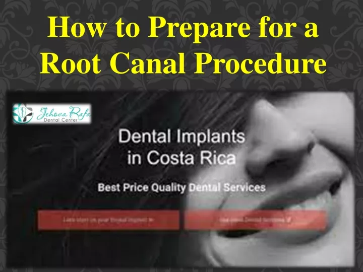 how to prepare for a root canal procedure